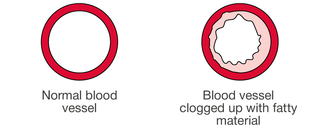 Diagram of blood vessels