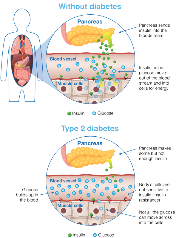 What happens in your body after you eat carbohydrate (carb) food?