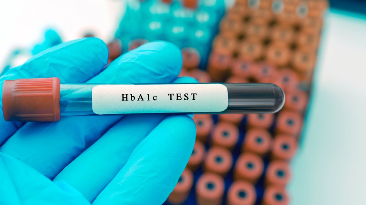 Haemoglobin A1c blood test